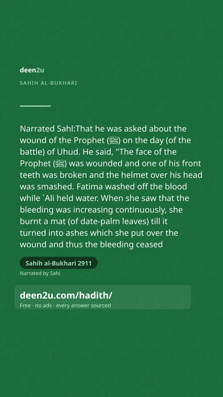 Sahih al-Bukhari 2911