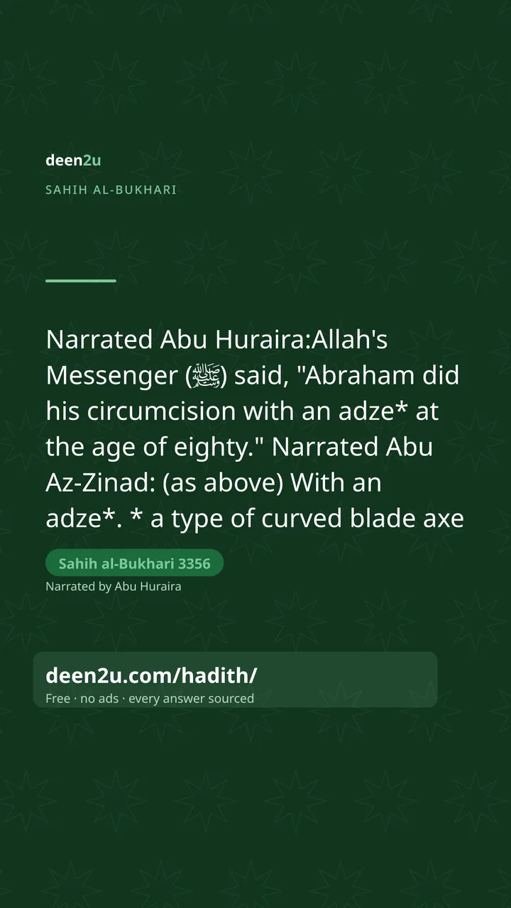Sahih al-Bukhari 3356