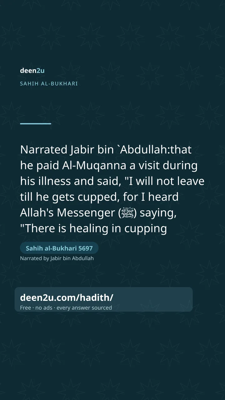 Sahih al-Bukhari 5697
