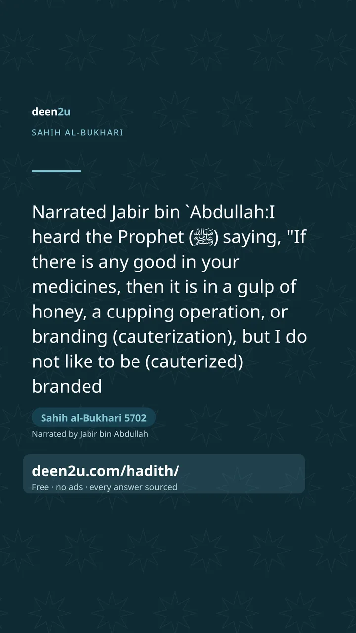 Sahih al-Bukhari 5702