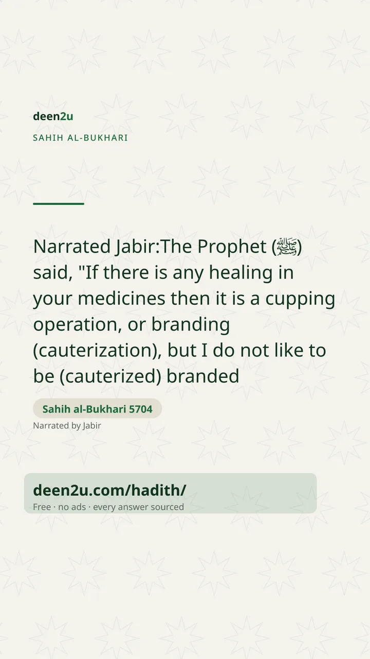 Sahih al-Bukhari 5704